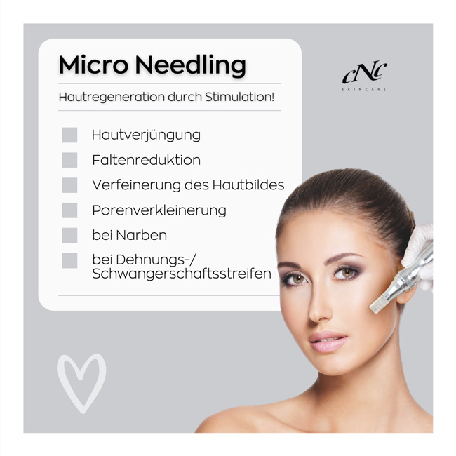 microneedling markkleeberg