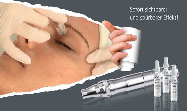 microneedling behandlungen markkleeberg 